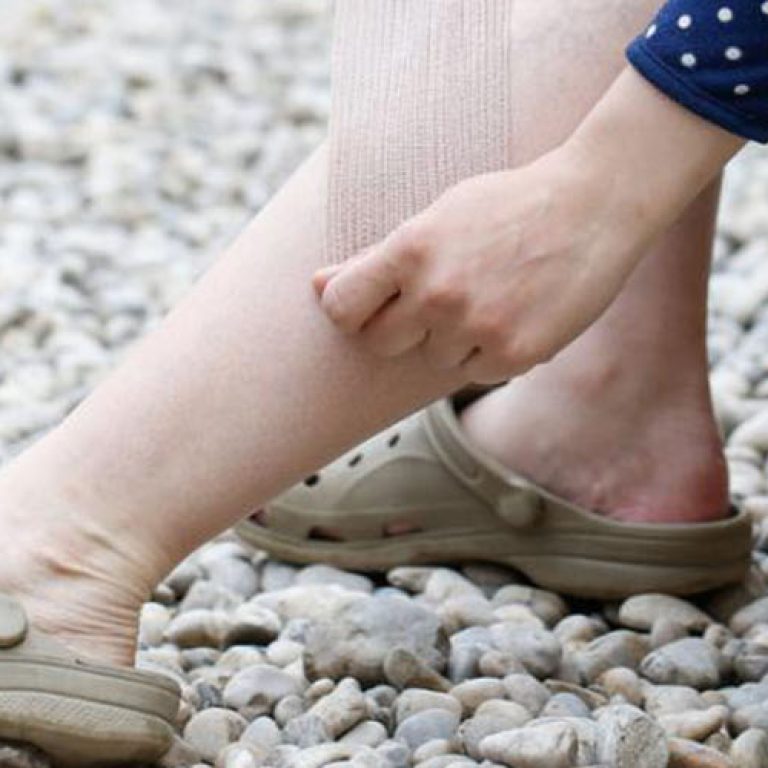 Best Shoes for Elderly With Edema